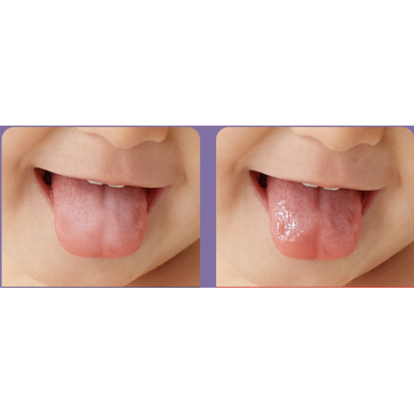 Комплект детски четки за зъби със скрепер за език HZS1020