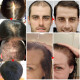 Серум за коса с корен от джинджифил подпомага растежа на коса HZS24B 3