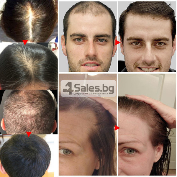 Серум за коса с корен от джинджифил подпомага растежа на коса HZS24B 3