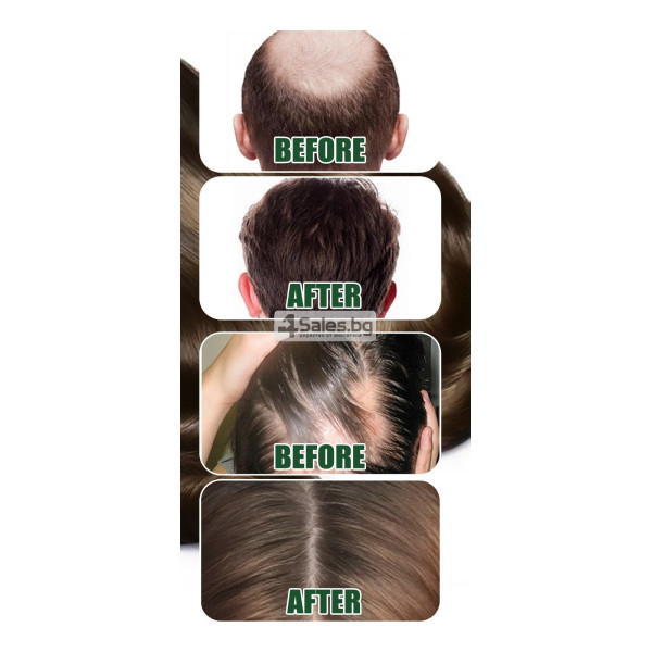 Многофункционален продукт за коса – растеж, заздравяване и сгъстяване HZS24 4