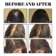 Етерично масло за коса подсилващ серум за контрол на омазняването,за плътна и здрава коса OUHOE HZT15 5