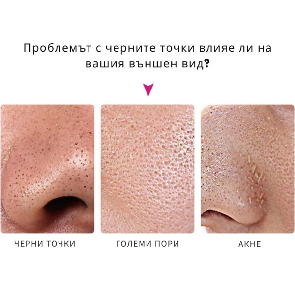 Ленти за премахване на черни точки Nose Mask - 10 броя 6