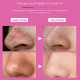 Ленти за премахване на черни точки Nose Mask - 10 броя 9