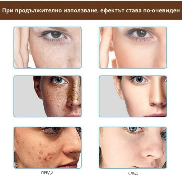 Крем за лице Mixia Rice Pretty Facial Cream - Избави се от акне, петна и пигментации 6