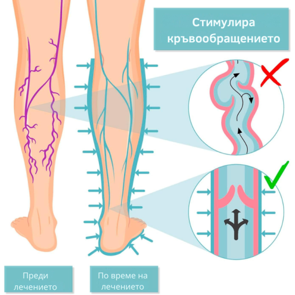 Апарат за венозно лечение и облекчение на тежестта в краката Venen Walker Basic 03123J0592 5