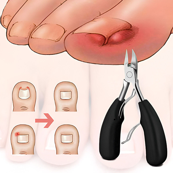 Професионален комплект за поддръжка на нокти – 5 части от неръждаема стомана