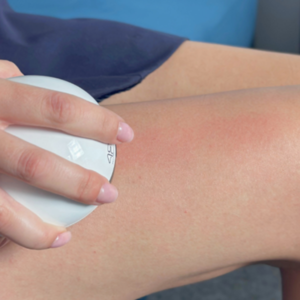 Антицелулитен масажор - терапия с червена светлина 3