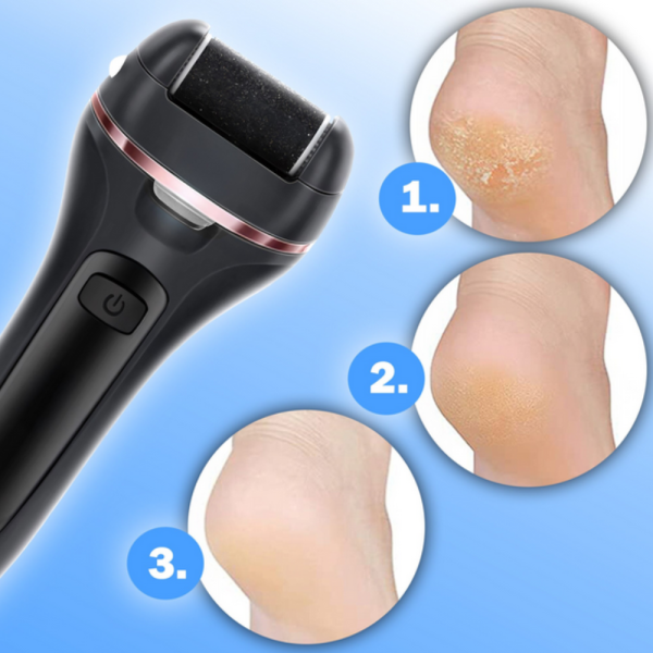 Електричска пила за крака - пълен комплект за базов педикюр 7