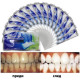 Избелващи ленти за зъби Advanced Teeth Whitening Strips TV268 5