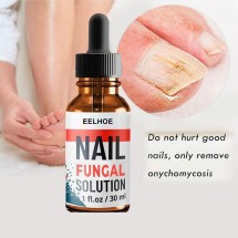 Продукт за лечение на гъбички по ноктите Eelhoe HZS485