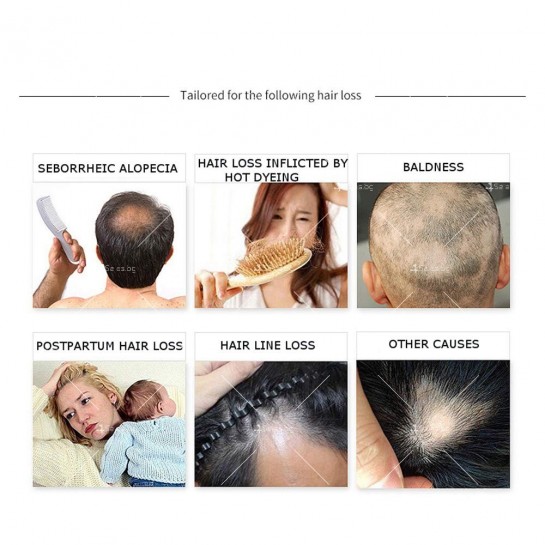 Етерично масло за коса против косопад, 30 мл, Естествени съставки - TV1134