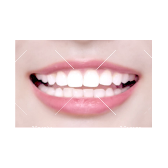 Ензимни избелващи ленти за зъби - HZS613