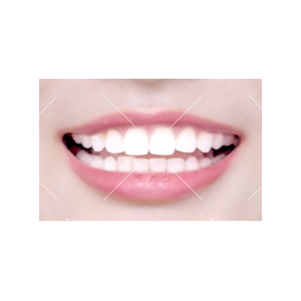 Ензимни избелващи ленти за зъби - HZS613 7