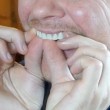 Instant Smile Lowers усмивка за минути TV1211-C 8