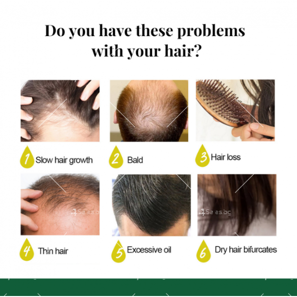 Многофункционален продукт за коса – растеж, заздравяване и сгъстяване HZS24 2