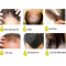 Многофункционален продукт за коса – растеж, заздравяване и сгъстяване HZS24 3