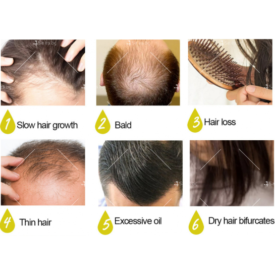 Многофункционален продукт за коса – растеж, заздравяване и сгъстяване HZS24