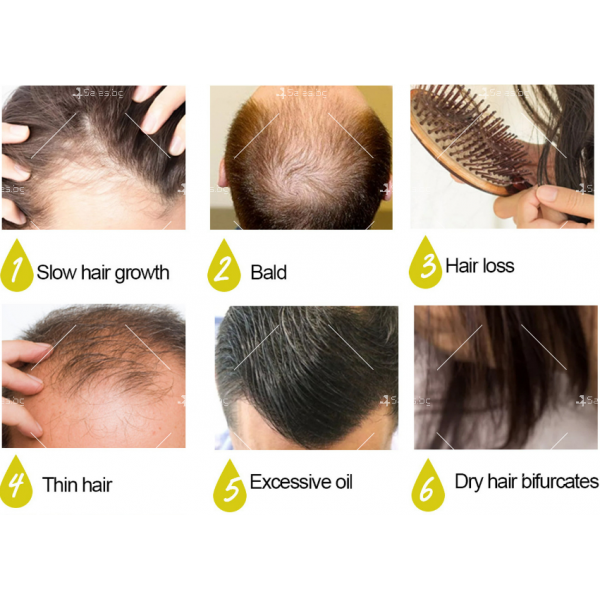 Многофункционален продукт за коса – растеж, заздравяване и сгъстяване HZS24 3