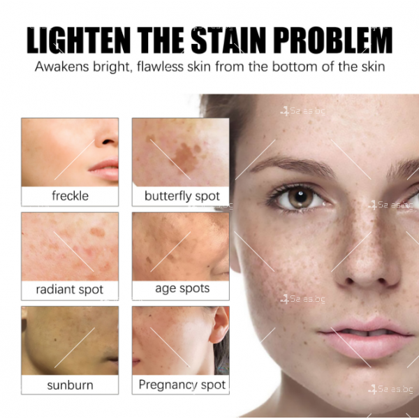 Крем срещу пигментация по кожата на лицето – изсветлява петна и лунички HZS3 5