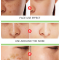 Крем срещу пигментация по кожата на лицето – изсветлява петна и лунички HZS3 10
