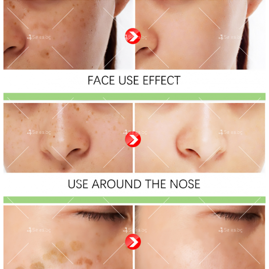 Крем срещу пигментация по кожата на лицето – изсветлява петна и лунички HZS3